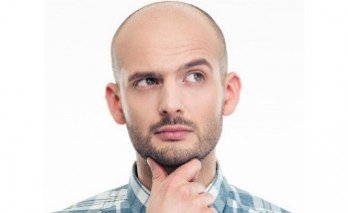 Things to be considered in hair transplant